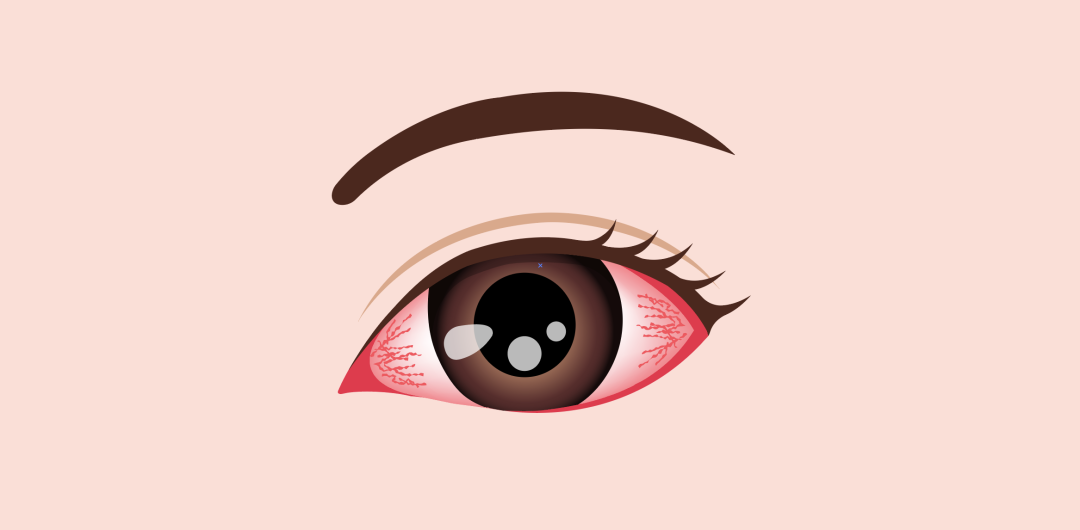 Blog Single